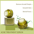 Reparatur von Narben Melasma Pickel Anti Acjetreatment Creme